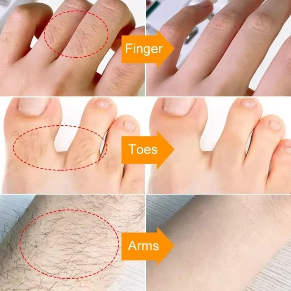3 Minutes Fast Hair Removal Cream Painless Hair Growth Inhibitor Lip Face Arm Armpit Leg Permanent Depilatory for Men Women Care